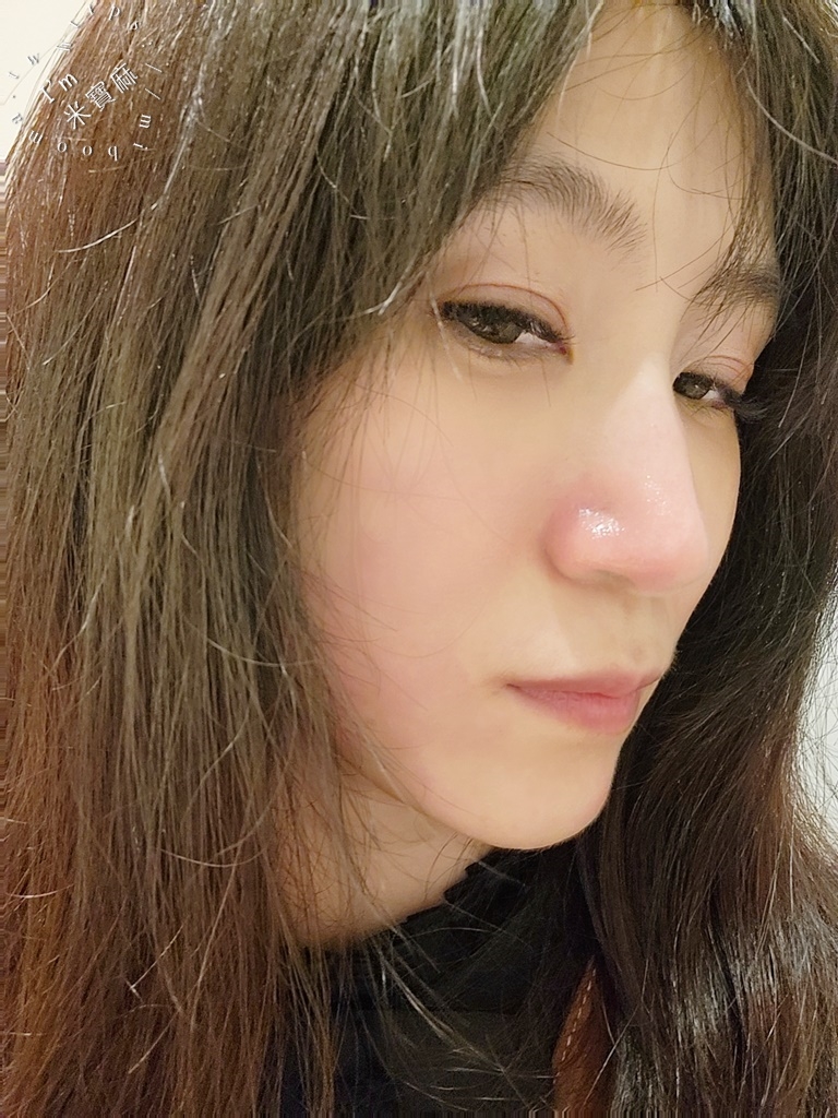 醫美診所推薦｜皙妍診所-讓你遠看很迷人，近看更動人 @米寶麻幸福滿載｜皙妍診所