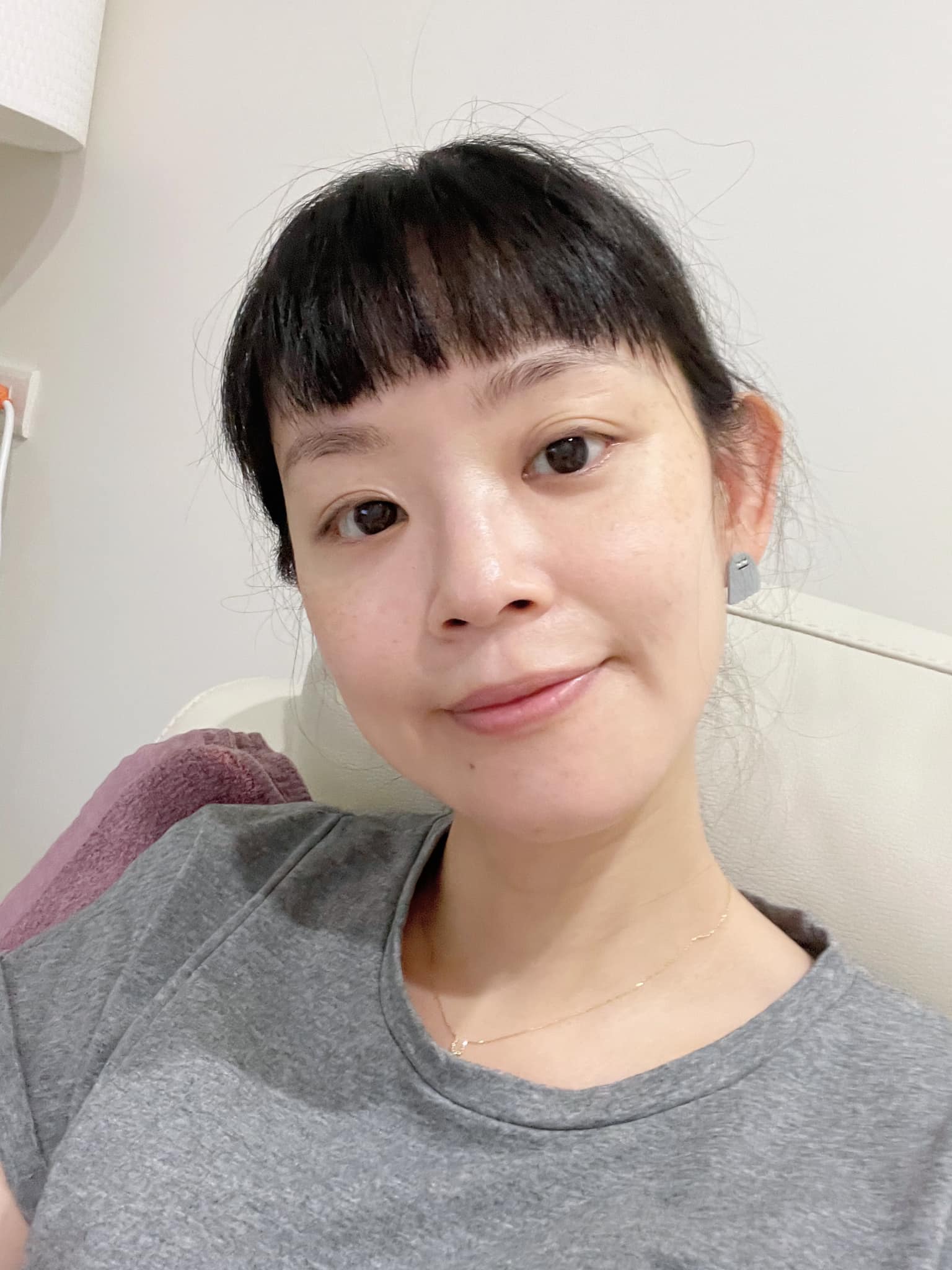 醫美診所推薦｜暗沈什麼的全都沒了!!!臉超級透亮!@葳葳 曾仲葳｜皙妍診所