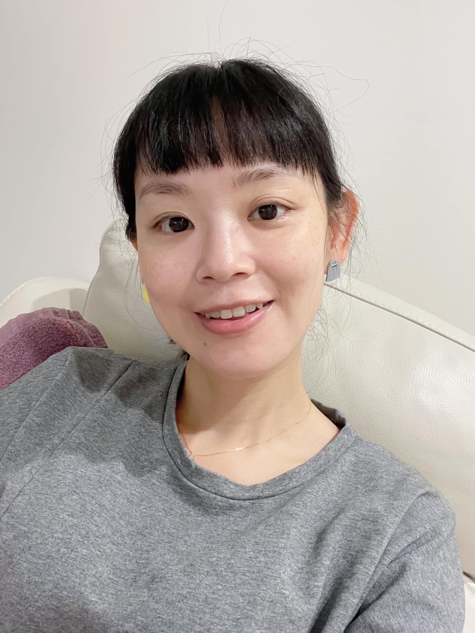 醫美診所推薦｜暗沈什麼的全都沒了!!!臉超級透亮!@葳葳 曾仲葳｜皙妍診所
