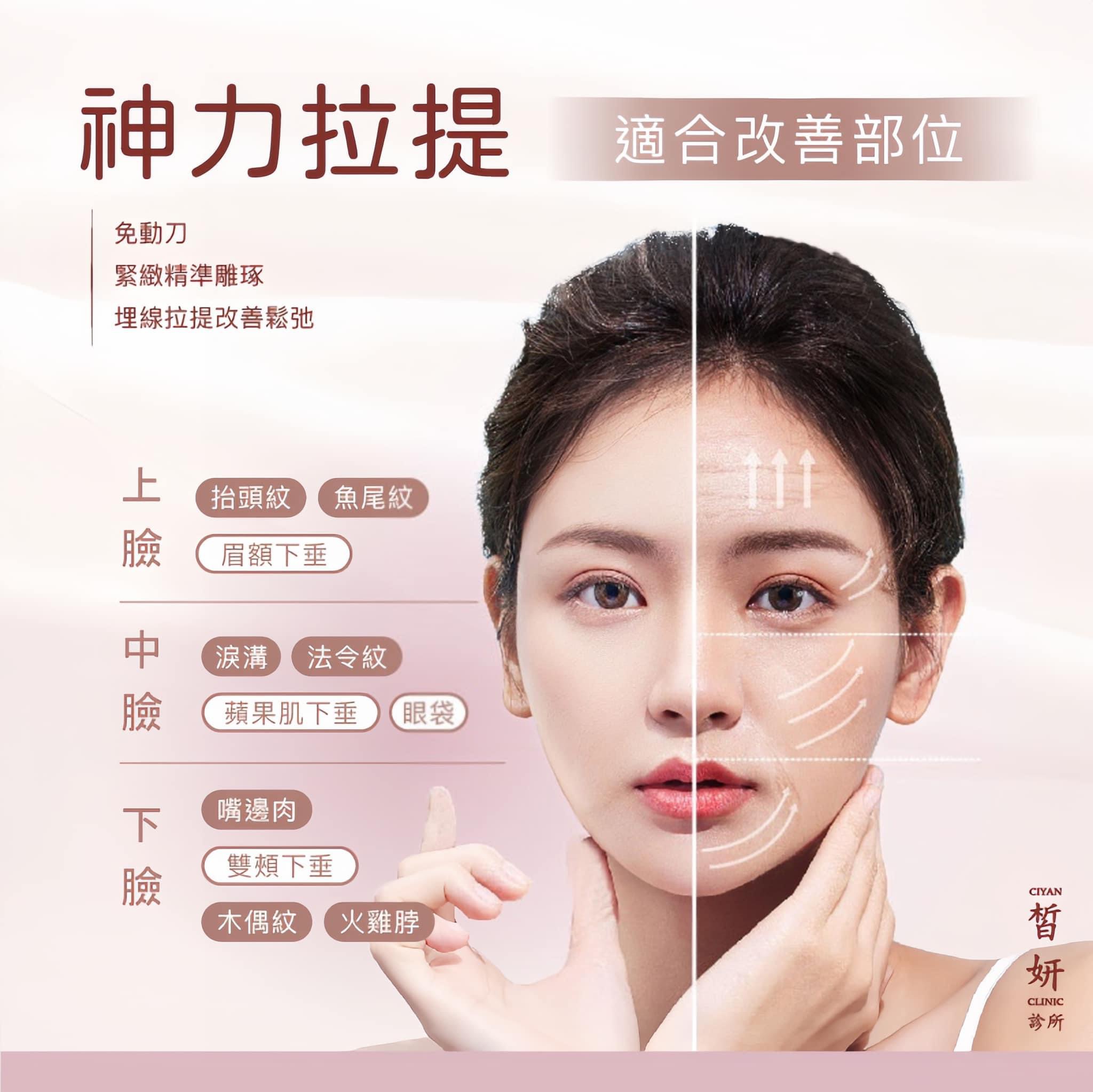 台北醫美、皙妍診所、臉部拉提、埋線