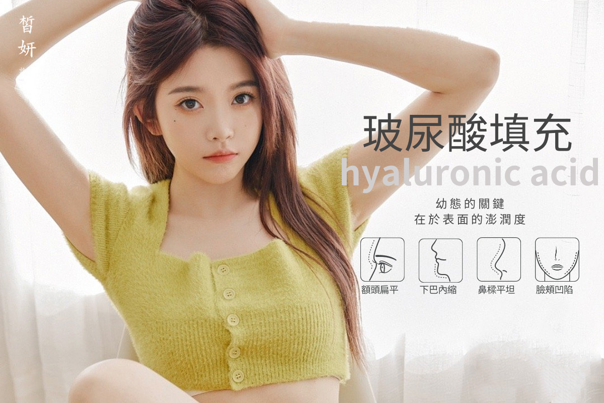 醫美診所推薦｜玻尿酸｜皙妍診所